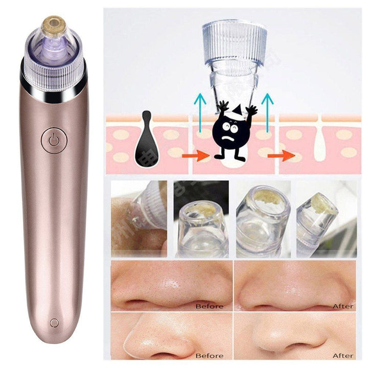 Aparat profesional pentru puncte negre WMZ-0801 4 capete - Sanatate si ingrijire