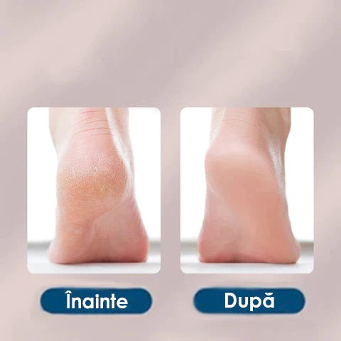 Pila electrica pentru calcaie BeautyFeet - Articole Femei