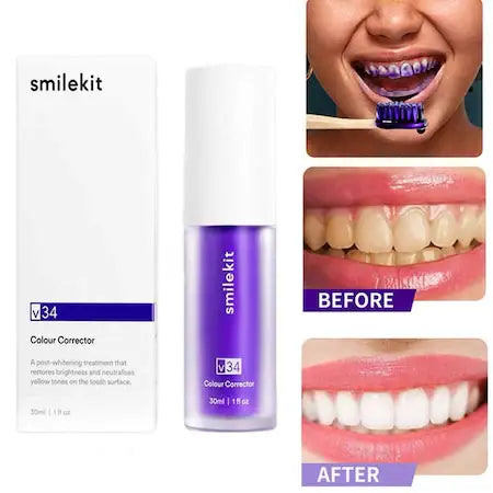 Imagine cu produsul Spuma Eficienta V34 SmileKit Pentru Albirea Dintilor 30ml pentru albirea dintilor